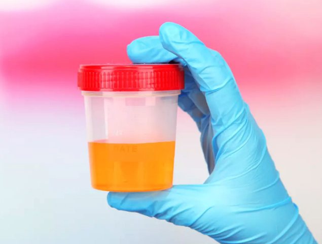 Jar of urine