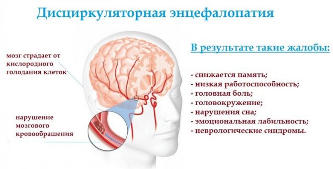 Дисциркуляторная энцефалопатия головного мозга 1, 2, 3 степени (ДЭП) — что это за диагноз?