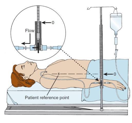 how to measure central venous pressure