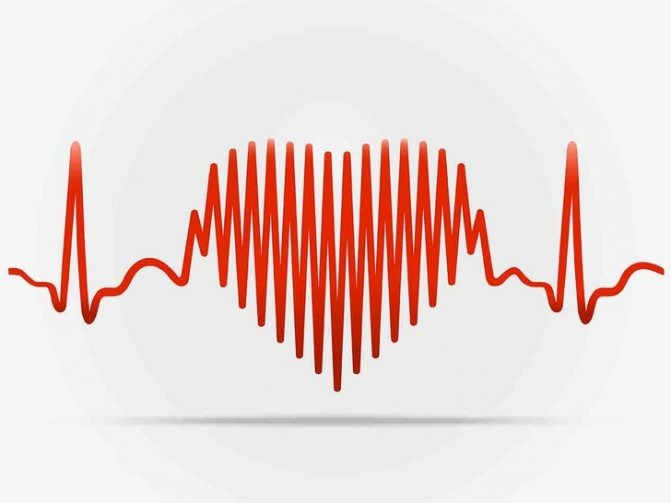 кардиограмма сердца