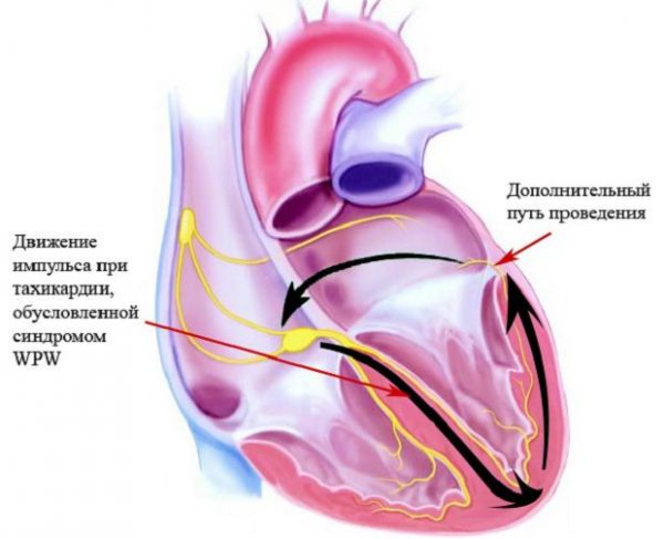 Mechanism of development of tachycardia
