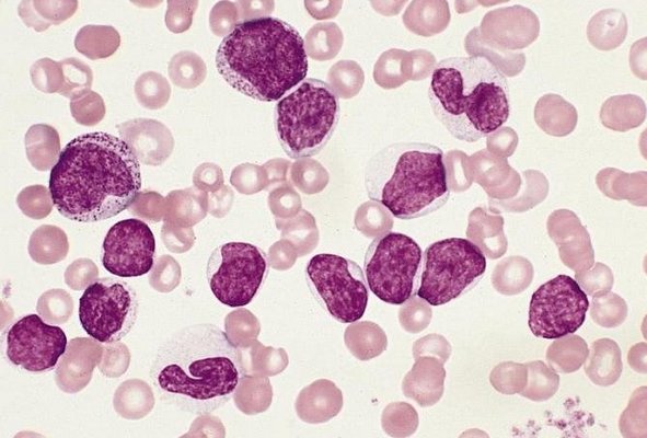 Monocytes in the blood