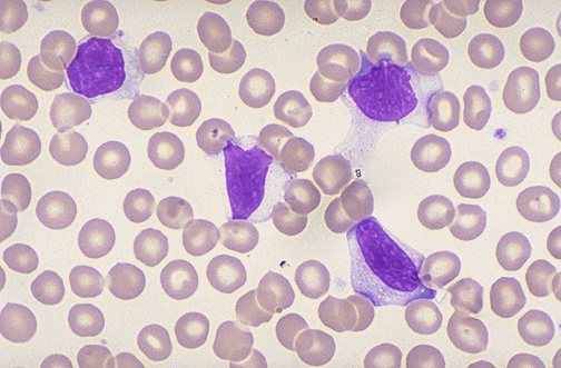 Norm of lymphocytes in the blood
