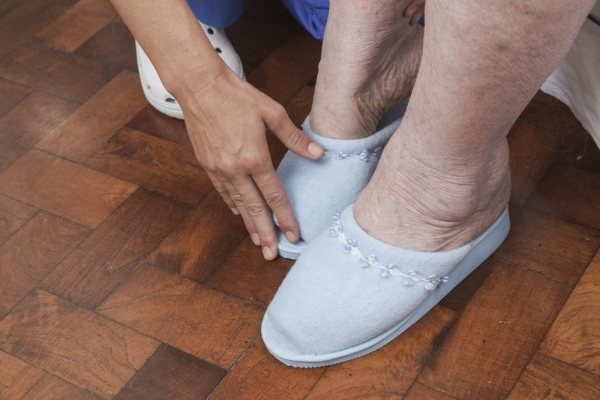 Leg swelling in the elderly