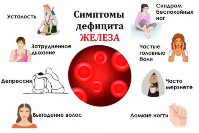 Poikilocytosis in general blood test causes