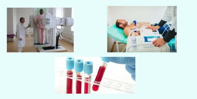 Рентген, ЭКГ и анализ крови