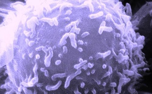 Blue lymphocyte under magnification