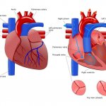 Сужение отверстия трехстворчатого клапана сердца